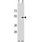 Pleckstrin Homology Domain Containing A1 (PLEKHA1) Antibody