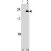 Fibroblast Growth Factor 19 (FGF19) Antibody