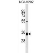 N-Acetylglucosamine-1-Phosphotransferase Subunit Gamma (GNPTG) Antibody