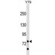 Rhophilin Rho GTPase Binding Protein 1 (RHPN1) Antibody