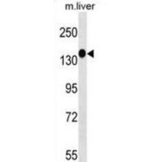 Tyrosine-Protein Kinase SgK269 (SGK269) Antibody