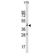 Lysosomal Associated Membrane Protein 2 (LAMP2) Antibody