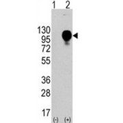Lysosomal Associated Membrane Protein 2 (LAMP2) Antibody