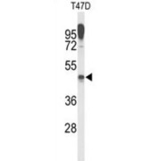 Lysosomal Associated Membrane Protein 2 (LAMP2) Antibody