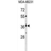Vomeronasal Type-1 Receptor 4 (VN1R4) Antibody