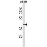 Fatty Acid Desaturase 3 (FADS3) Antibody