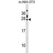 FGFR1 Oncogene Partner 2 (FGFR1OP2) Antibody