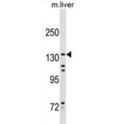 Kinesin Family Member 15 (KIF15) Antibody