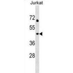 Lysosomal Associated Membrane Protein 3 (LAMP3) Antibody