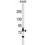 E3 Ubiquitin-Protein Ligase RNF157 (RNF157) Antibody