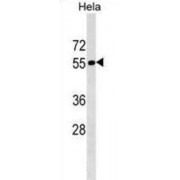 Tigger Transposable Element-Derived Protein 1 (TIGD1) Antibody