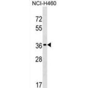 TP53 Target Gene 5 (TP53TG5) Antibody