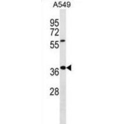 WD Repeat-Containing Protein 61 (WDR61) Antibody