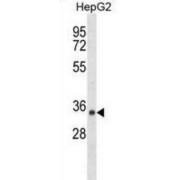 Short Chain Dehydrogenase/Reductase Family 39U Member 1 (SDR39U1) Antibody