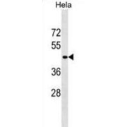 Serpin Family B Member 11 (gene/pseudogene) (SERPINB11) Antibody