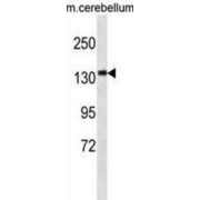 Calmodulin-Regulated Spectrin-Associated Protein 3 (CAMSAP3) Antibody