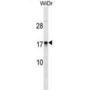 CMT1A Duplicated Region Transcript 4 Protein Homolog (CDRT4) Antibody