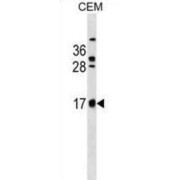 CB083 Antibody