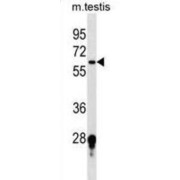 Alpha-(1,3)-Fucosyltransferase 11 (FUT11) Antibody