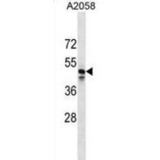 MAS Related GPR Family Member F (MRGPRF) Antibody