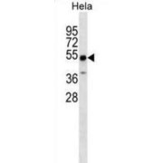 Zinc Finger And SCAN Domain-Containing Protein 4 (ZSCAN4) Antibody