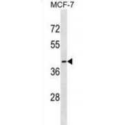 Olfactory Receptor Family 56 Subfamily B Member 1 (OR56B1) Antibody