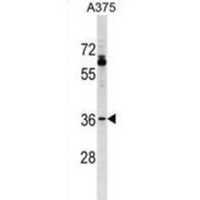 Olfactory Receptor Family 51 Subfamily T Member 1 (OR51T1) Antibody