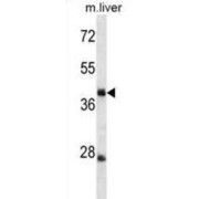 Tripartite Motif-Containing Protein 44 (TRIM44) Antibody