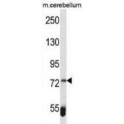 Zinc Finger And BTB Domain-Containing Protein 39 (ZBTB39) Antibody