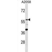 Zinc Finger Protein 776 (ZNF776) Antibody