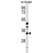 Methyltransferase Like Protein 6 (METTL6) Antibody