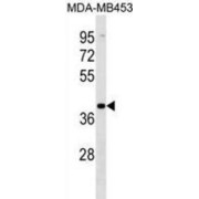 Vomeronasal 1 Receptor 2 (VN1R2) Antibody