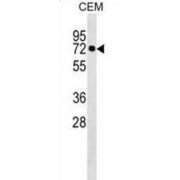 Kelch-Like Protein 28 (KLHL28) Antibody