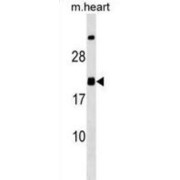 Mediator of RNA Polymerase II Transcription Subunit 9 (MED9) Antibody