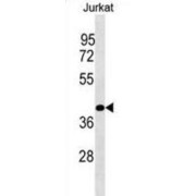 Phosphatidylinositol Specific Phospholipase C X Domain Containing 1 (PLCXD1) Antibody