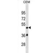 SP140L Antibody