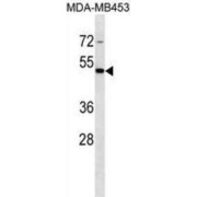 SH3 And Cysteine Rich Domain (STAC) Antibody