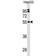 O-Phosphoseryl-tRNA(Sec) Selenium Transferase (SEPSECS) Antibody