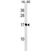 Diphosphoinositol Polyphosphate Phosphohydrolase 3-Alpha (NUDT10) Antibody