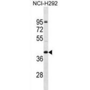 Olfactory Receptor 2T5 (OR2T5) Antibody