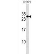 POM121 And ZP3 Fusion Protein (POMZP3) Antibody