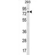 Zinc Finger Protein 416 (ZNF416) Antibody