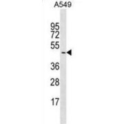 Glycogenin 2 (GYG2) Antibody