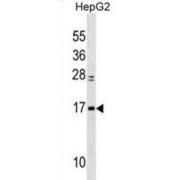 Myosin Light Polypeptide 6 (MYL6) Antibody