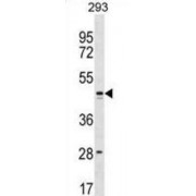 Transmembrane Protein FAM155B (FAM155B) Antibody