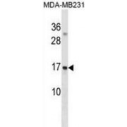 Gamma-Aminobutyric Acid Receptor-Associated Protein-Like 3 (GABARAPL3) Antibody
