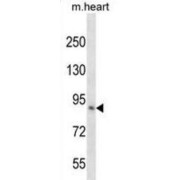 Kelch Like Family Member 1 (KLHL1) Antibody