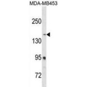 Ribosome-Binding Protein 1 (RRBP1) Antibody