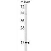 Homeobox Protein Hox-A1 (HOXA1) Antibody