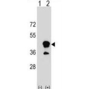 T-cell Surface Glycoprotein CD1b (CD1B) Antibody